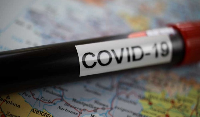 COVID-19 labeled blood test. 