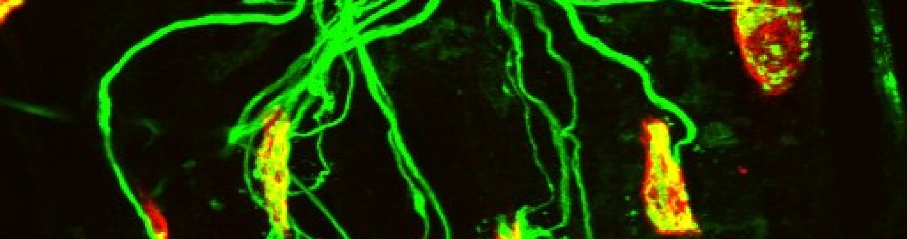 A neuromuscular junction. 