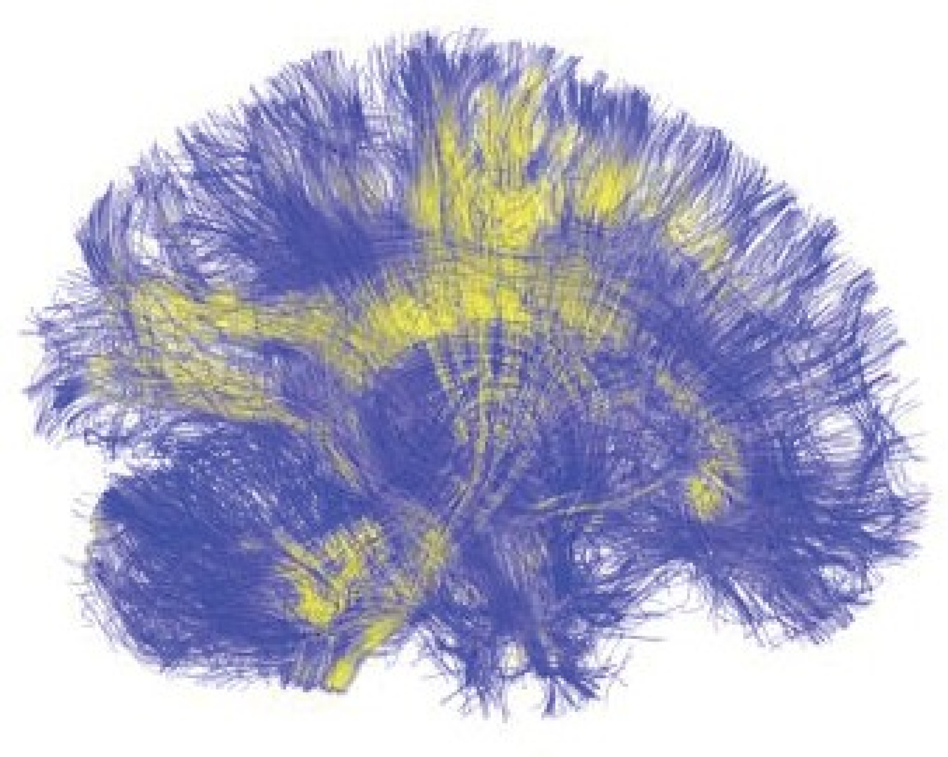 A visualization of the brain. 
