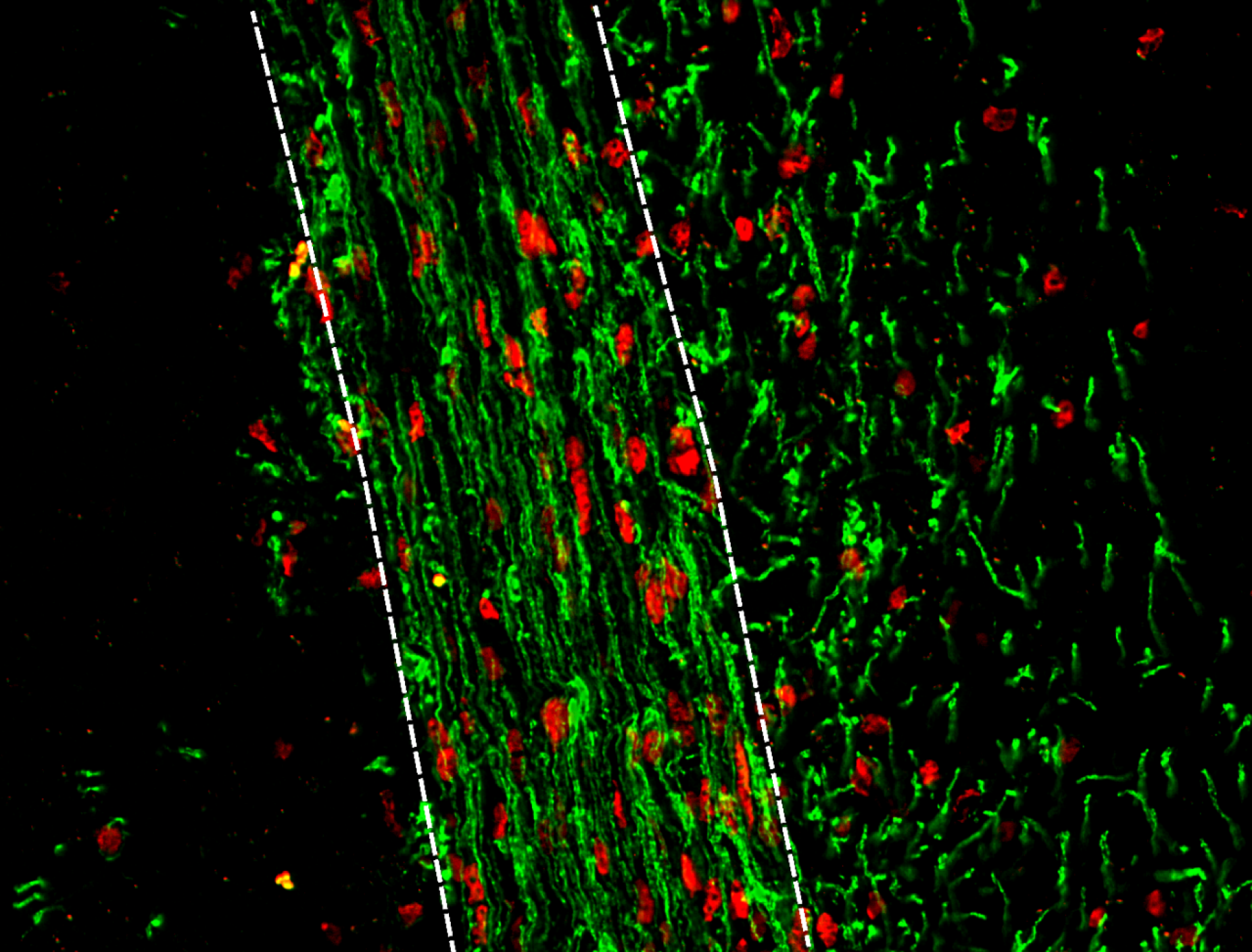 An oligodendrocyte progenitor cell (OPC).