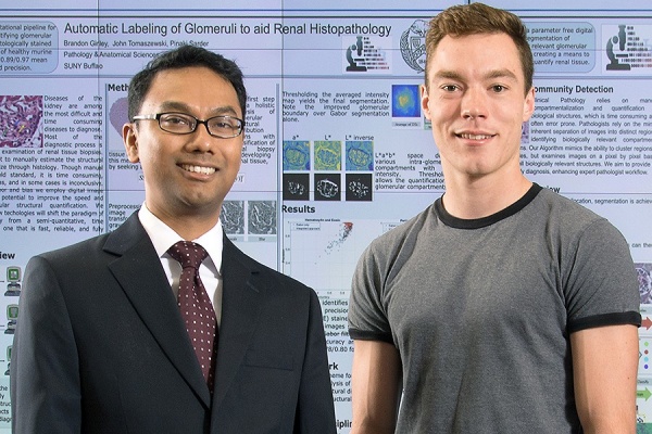 Pinaki Sarder, assistant professor Department of Pathology and Anatomical Sciences (left) and lead author Brendon Lutnick, doctoral candidate at the Jacobs School of Medicine and Biomedical Sciences. 