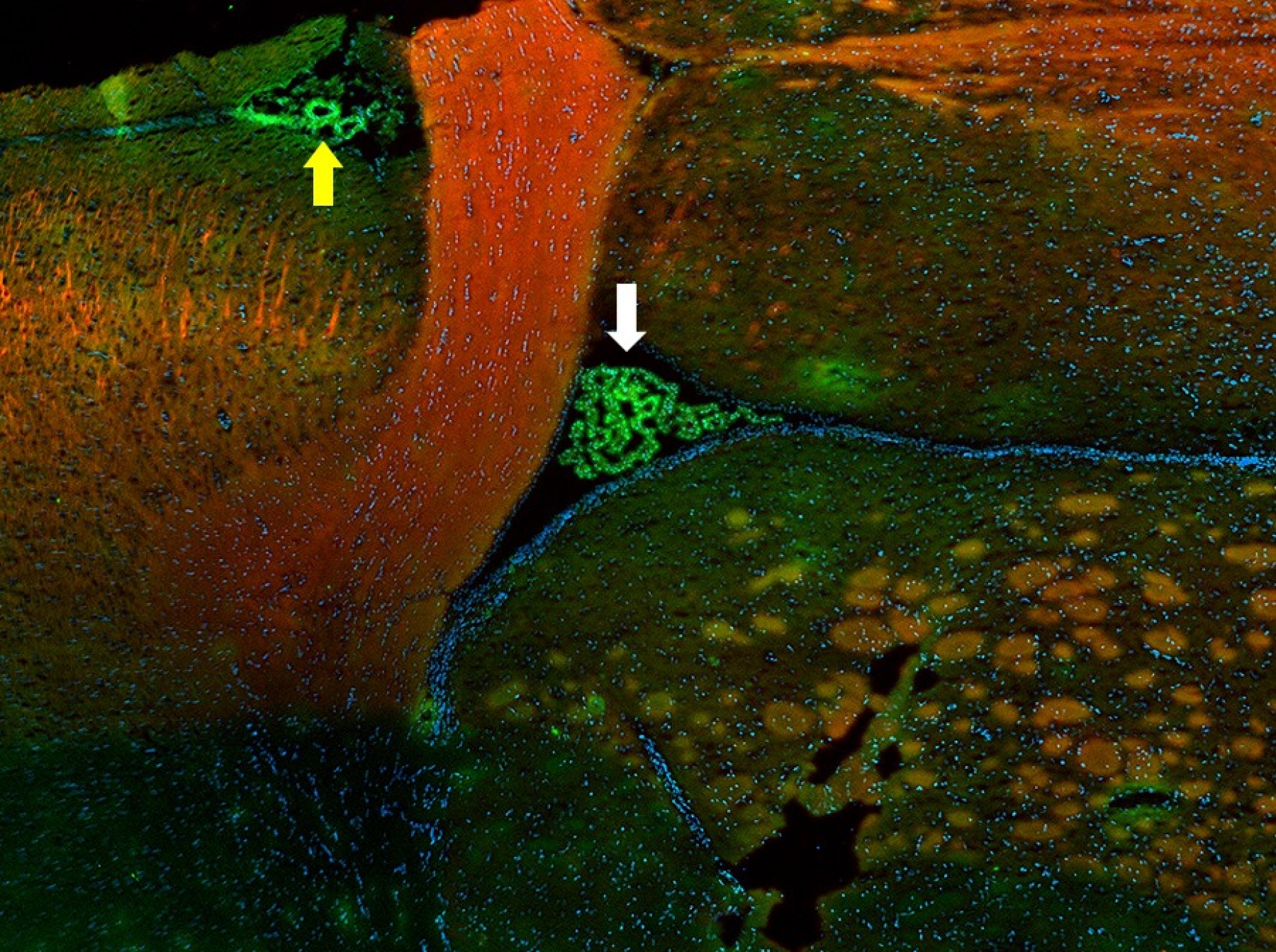 Color image indicating that TNF antibody has reached the brain. 