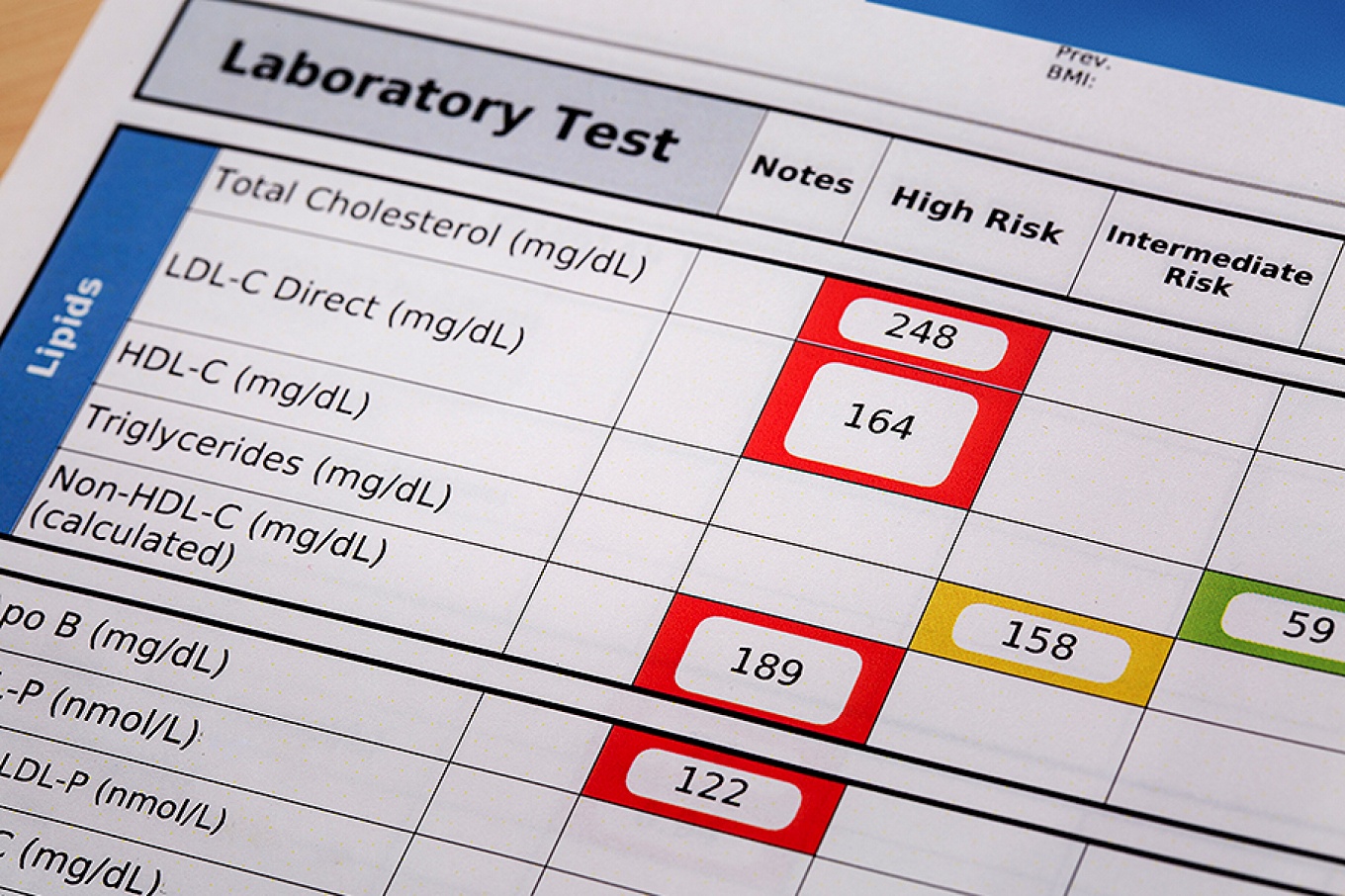 High risk cholesterol test results. 