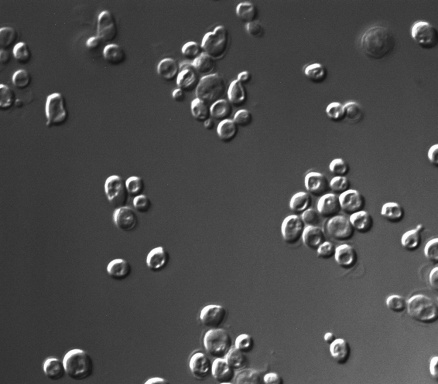 Zoom image: Baker’s yeast, or Saccharomyces cerevisiae, seen through a microscope in the lab of UB biologist Laura Rusche. Each round object is an individual yeast cell. The cells pictured are a laboratory strain of S. cerevisiae, but wild yeast look essentially the same, Rusche says. Credit: Ashleigh Hanner 