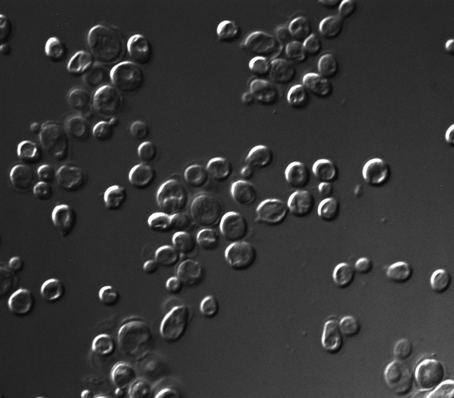Zoom image: Baker&rsquo;s yeast, or Saccharomyces cerevisiae, seen through a microscope in the lab of UB biologist Laura Rusche. Each round object is an individual yeast cell. The cells pictured are a laboratory strain of S. cerevisiae, but wild yeast look essentially the same, Rusche says. Credit: Ashleigh Hanner 