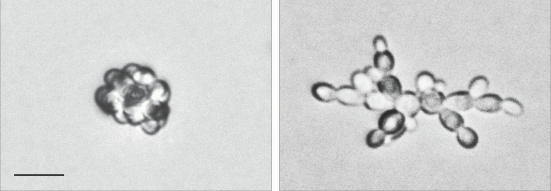 Zoom image: Colonies of baker&rsquo;s yeast, or Saccharomyces cerevisiae, pictured under a microscope. Yeast don&rsquo;t grow this way in bread dough: The images are from a 2016 study in the lab of UB biologist Paul Cullen that explored cellular mechanisms that cause certain changes in yeast growth patterns. In glucose-rich conditions on a flat laboratory plate (left), the yeast cells grow in a tight cluster. But when glucose is limited (right), new cells grow outward, forming a filament-like configuration that may aid in the search for food. Bar, 10 microns. Credit: Paul J. Cullen 