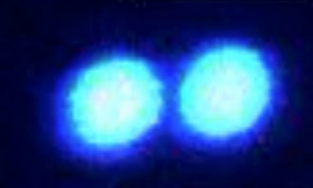 Zoom image: Micron-sized protein-RNA condensates containing "fused in sarcoma," a disordered protein linked to ALS, are visualized through a confocal fluorescence microscope. Credit: Priya Banerjee Lab at UB 