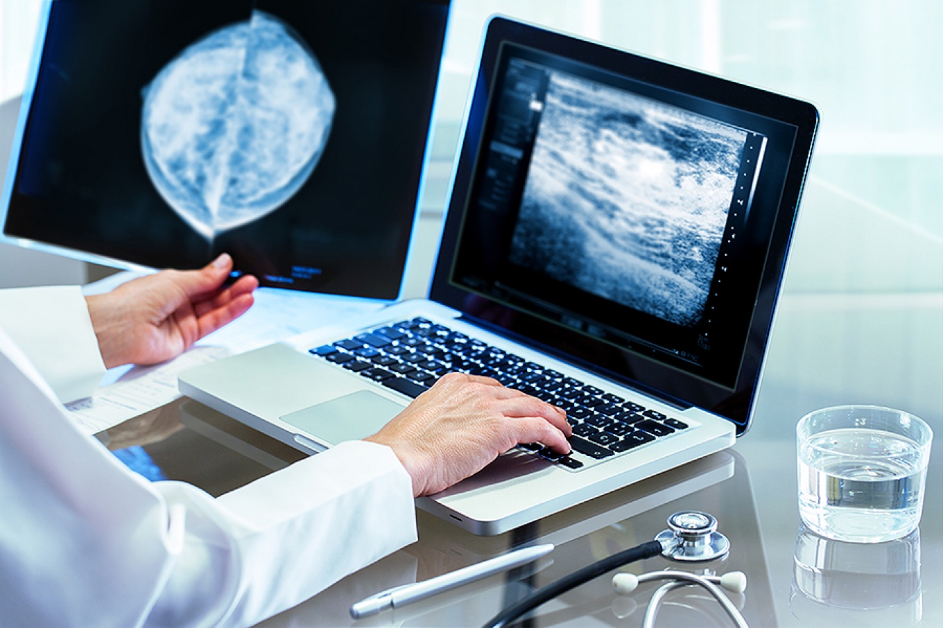 Doctor reviewing mammography results on pc. 
