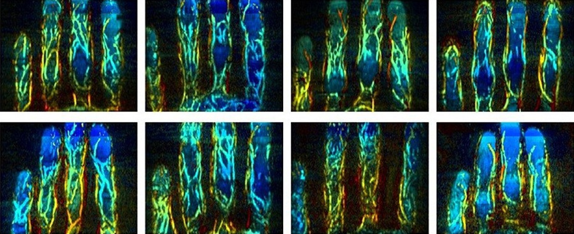 Zoom image: Researchers developed a new biometric approach that uses 3D images of finger veins. Shown are finger vessel images from eight different subjects, with colors that represent different depths. Photo: Jun Xia 