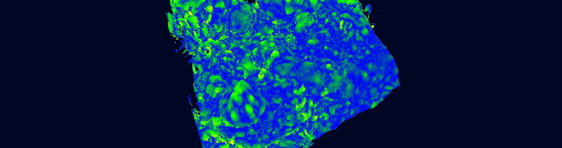 Zoom image: A 3D model consisting of areas of blue and green hues sprinkled across an uneven surface.