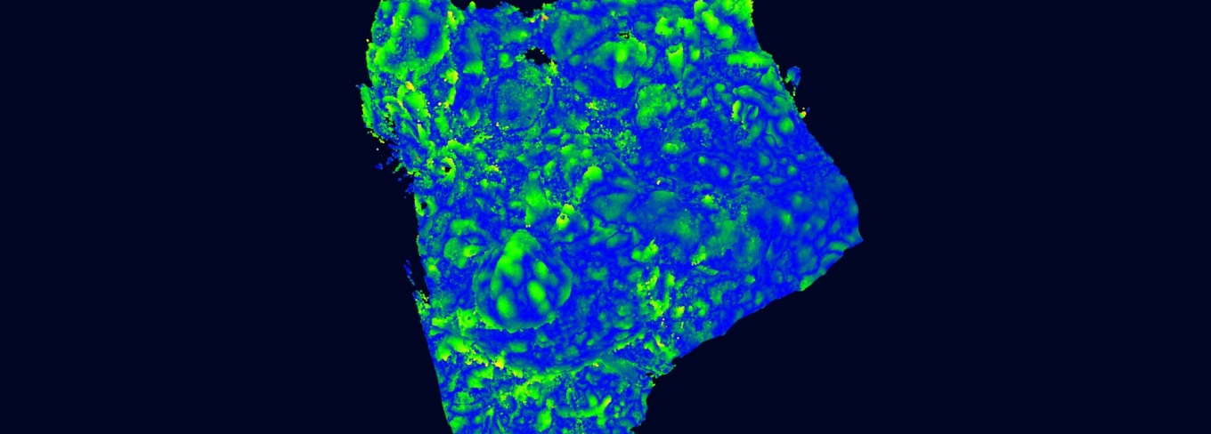 Zoom image: A 3D model consisting of areas of blue and green hues sprinkled across an uneven surface.