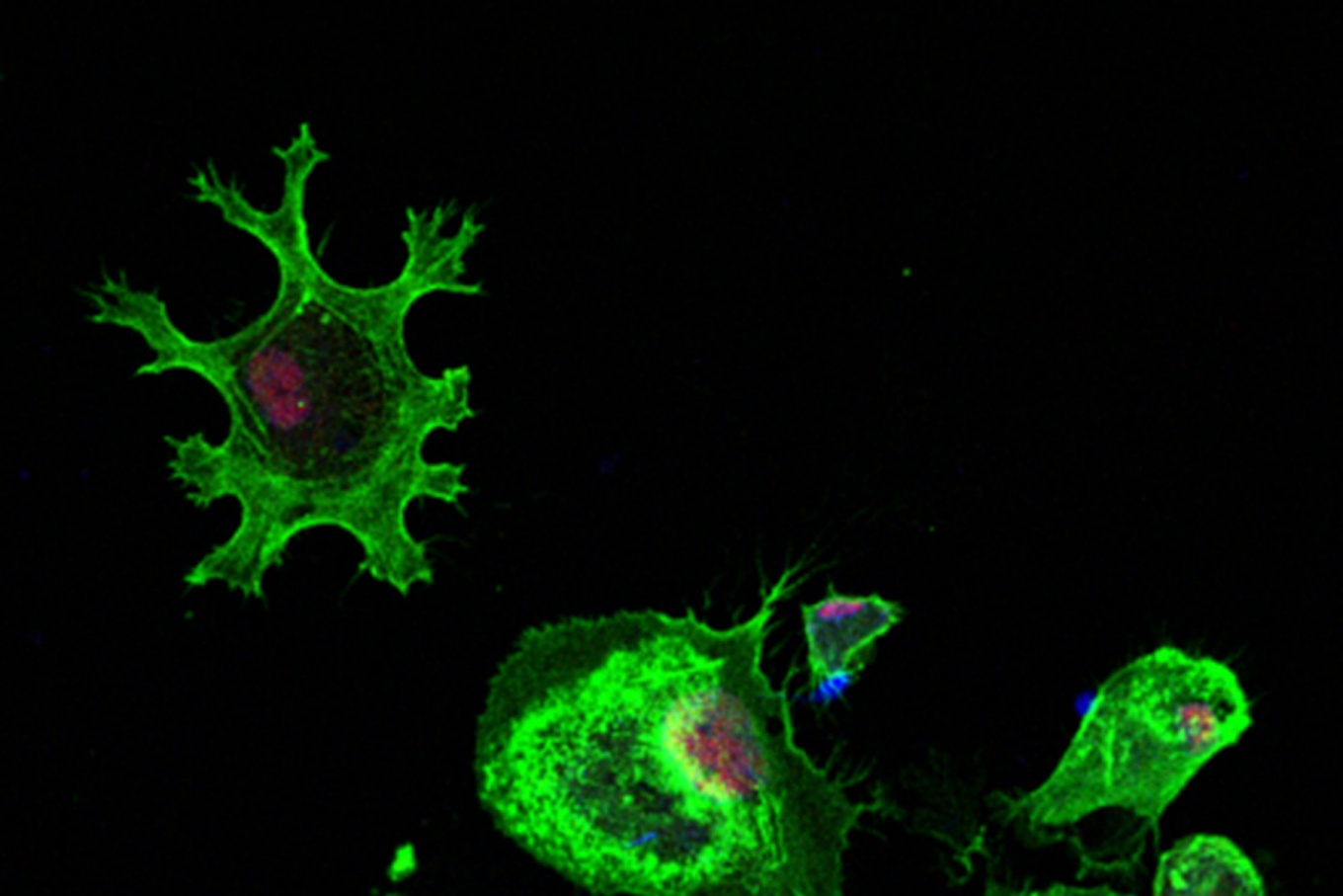 This confocal image of a macrophage (a type of white blood cell in the immune system) differentiated from induced pluripotent stem cells shows that the human specific gene CHRFAM7A rearranges the actin cytoskeleton (green). Photo: Szigeti lab.