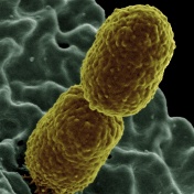 Colorized scanning electron micrograph showing carbapenem-resistant Klebsiella pneumoniae interacting with a human neutrophil. 