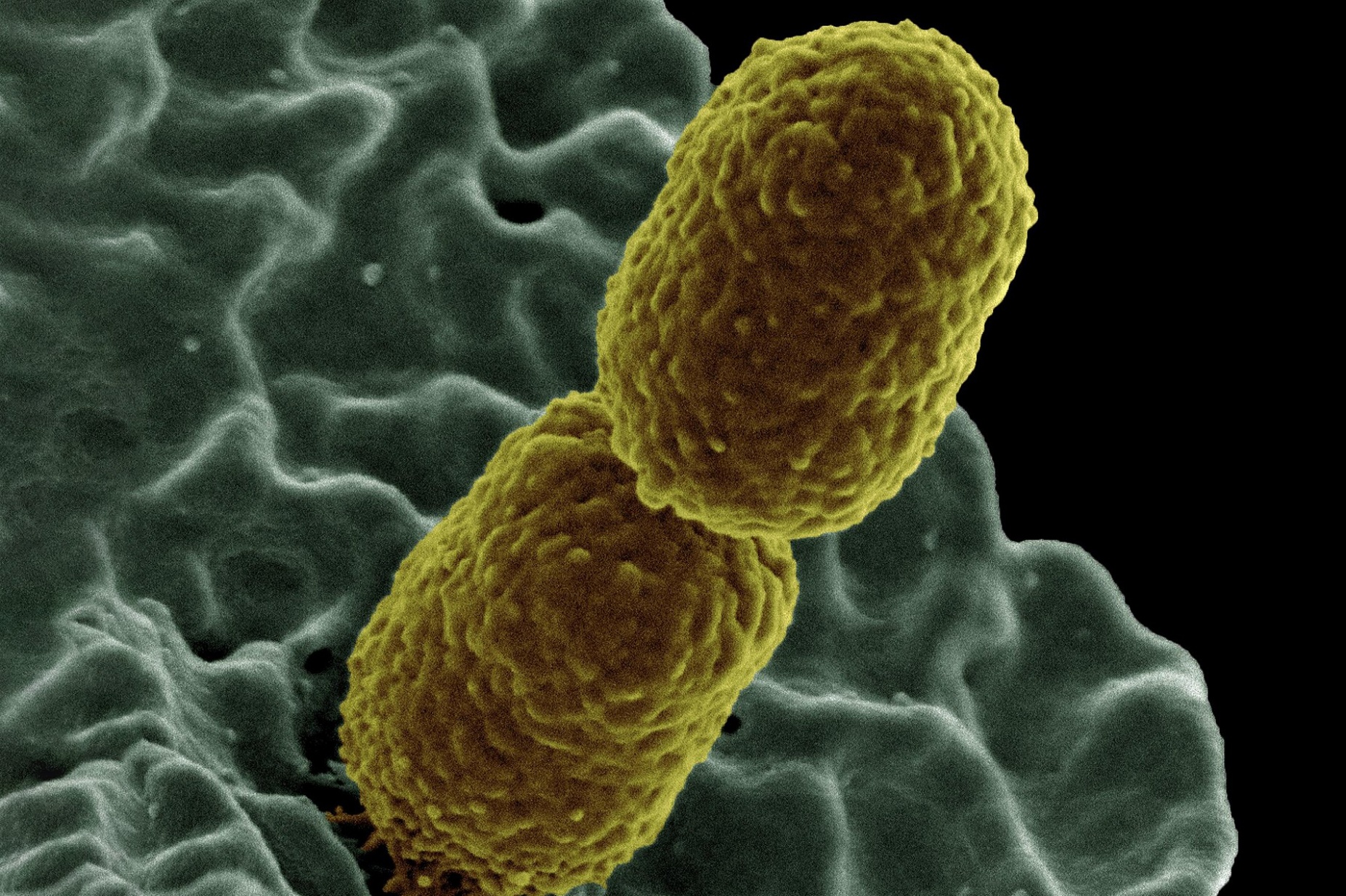 Colorized scanning electron micrograph showing carbapenem-resistant Klebsiella pneumoniae interacting with a human neutrophil. 