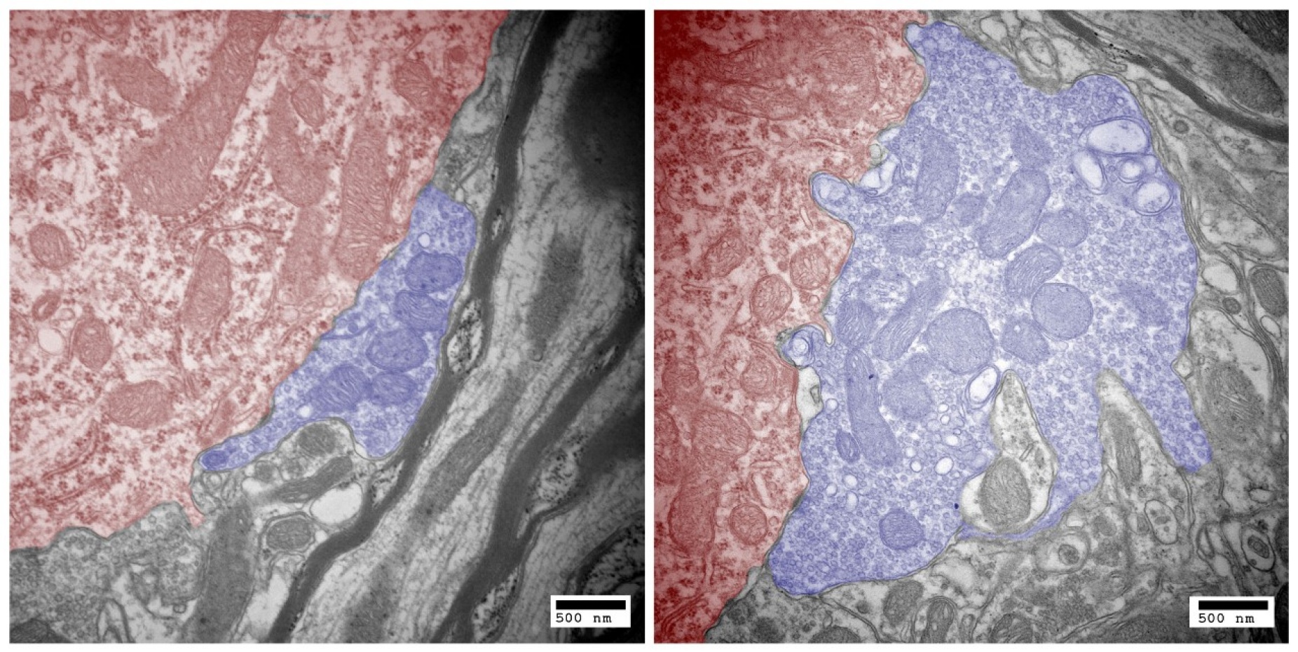 A synapse formed by the auditory nerve in a normal mouse and in a mouse exposed to noise for a week. 