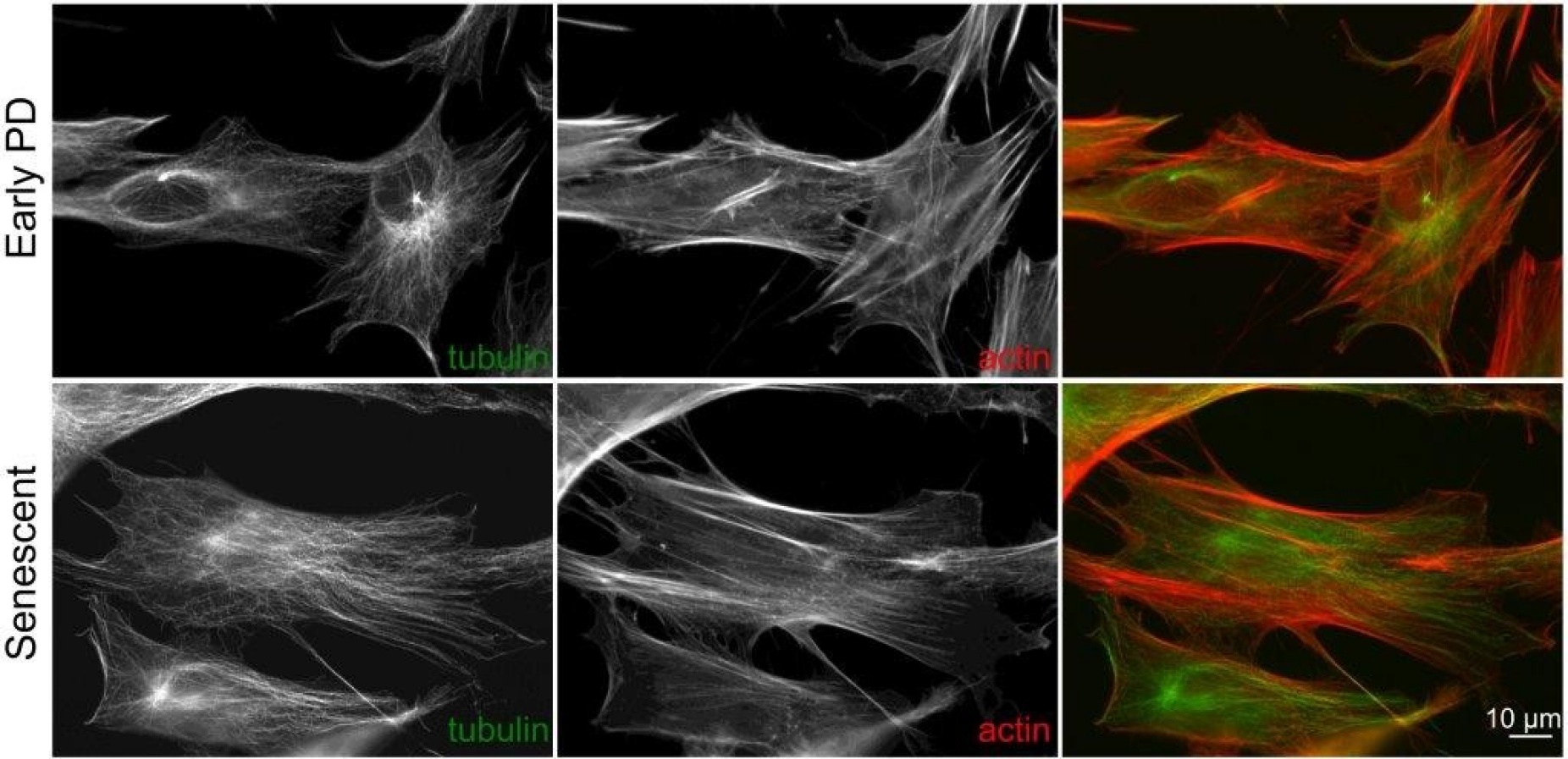 Images show the key structural proteins actin and tubulin as cells age. One shows cells still dividing, and the other shows senescent (cells that no longer divide) cells.