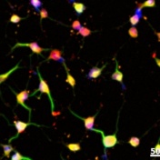 A neuron that began as a neural crest stem cell. 