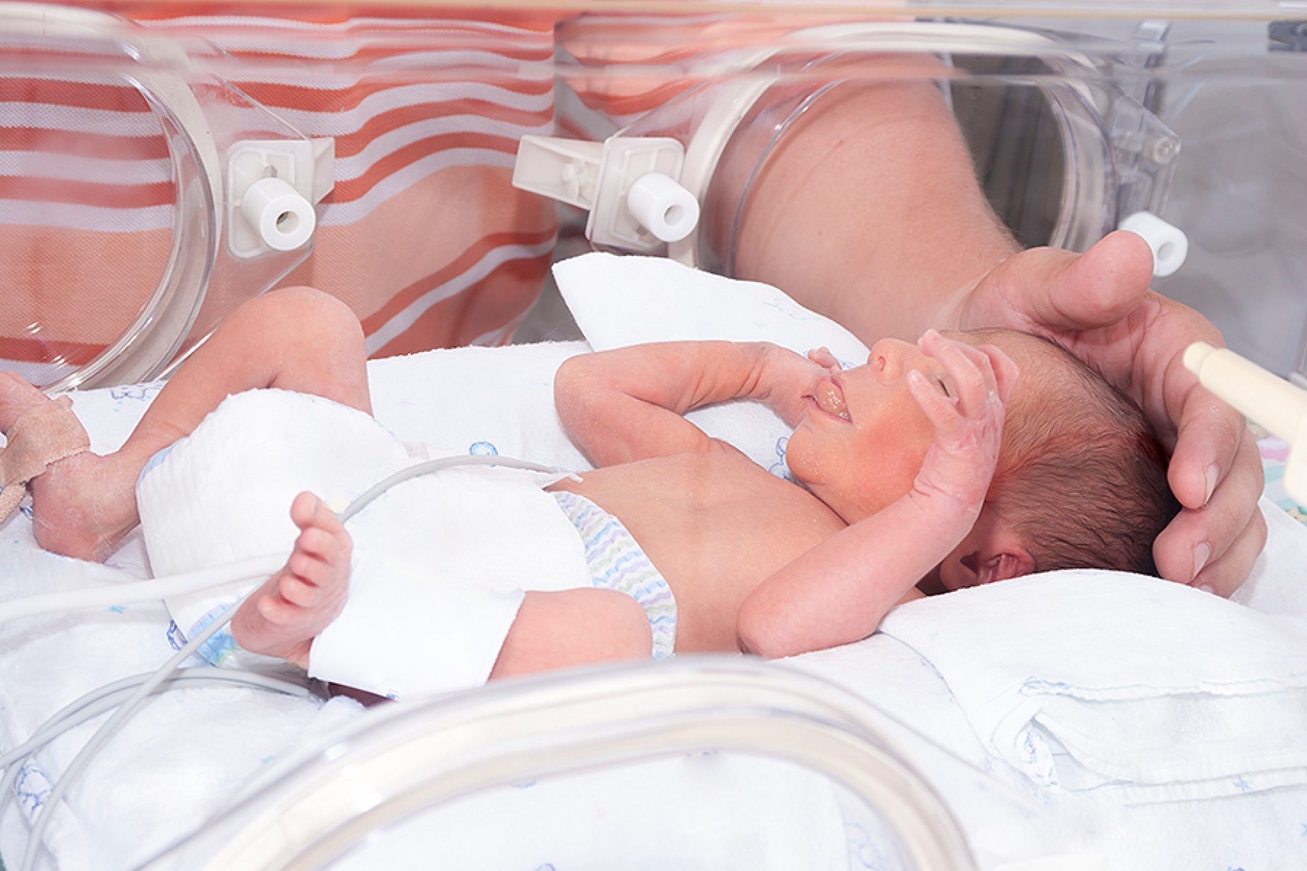 A tiny infant in an incubator. 