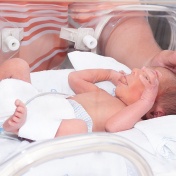 A tiny infant in an incubator. 