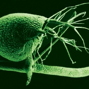 Scanning electron micrograph of the humped bladderwort plant. 