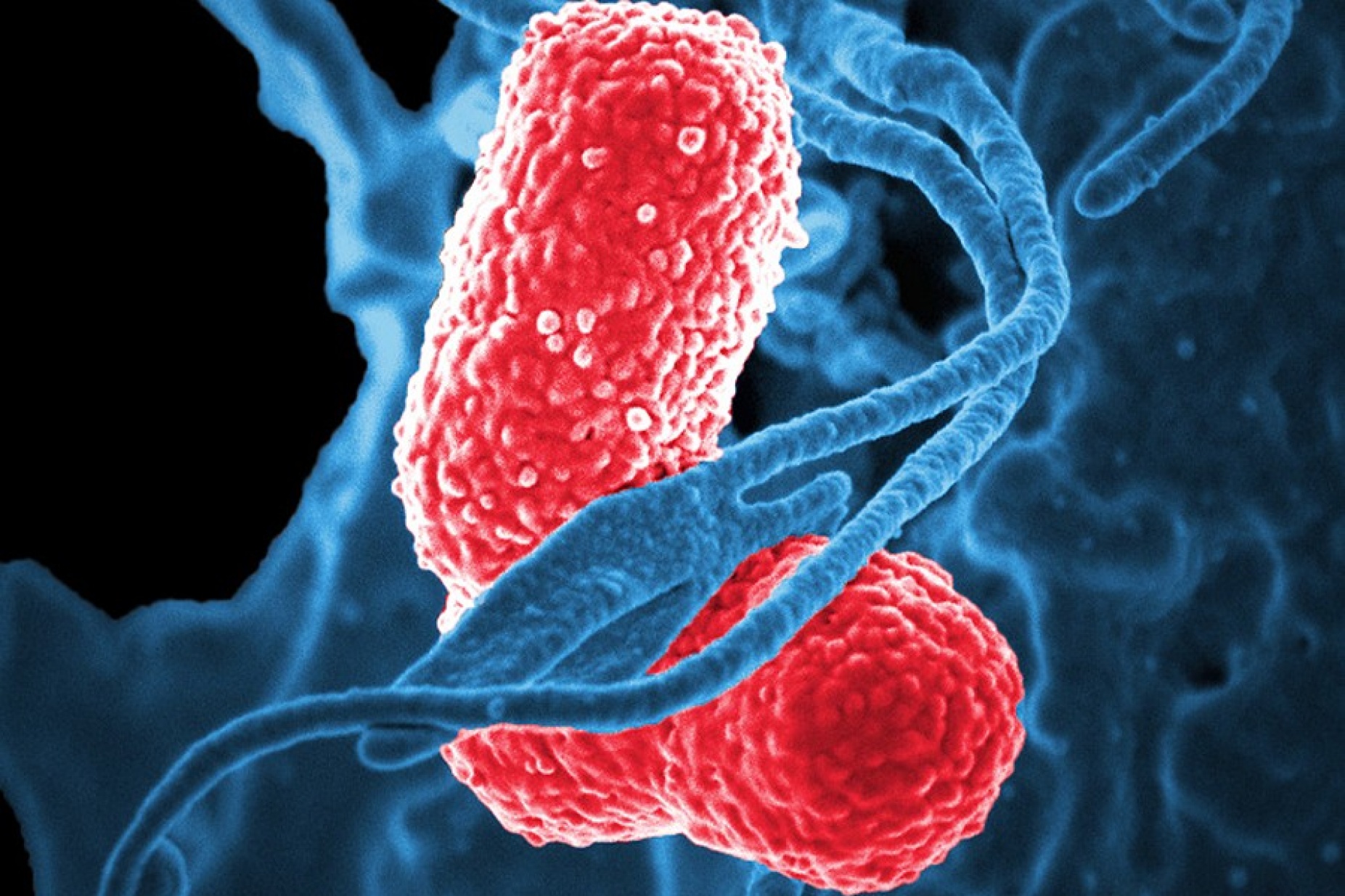 A digitally-colorized scanning electron micrograph depicts a blue-colored, human white blood cell interacting with two pink-colored, rod-shaped, multidrug-resistant Klebsiella pneumoniae bacteria. 