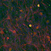 Fluorescence microscopy image of in vitro model of myelin sheath formation by Schwann cells around neuronal axons. 
