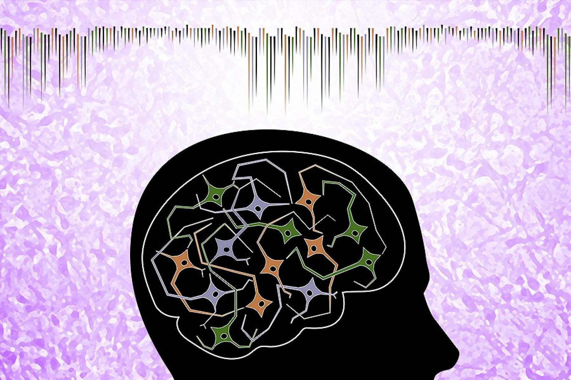 Conceptual illustration of the results of Parkinson's research. 