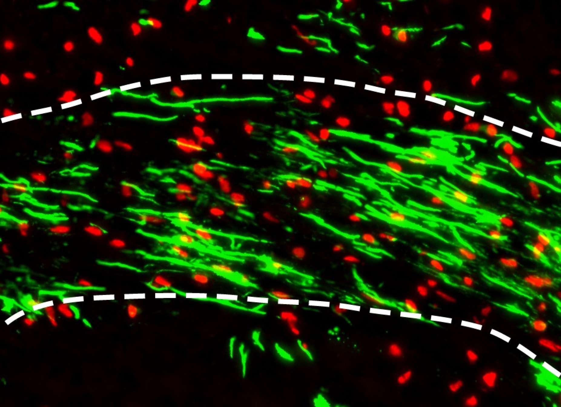 Figure showing the production of human myelin by transplanted human OPCs. 