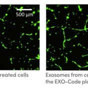 Exosomes. 