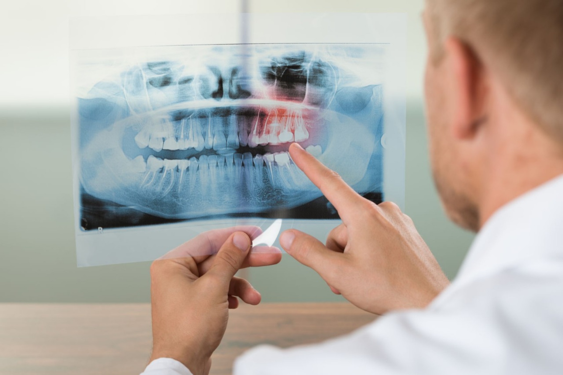 Man looking at a full-mouth X-ray. 
