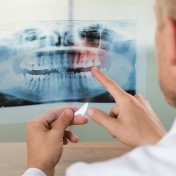 Man examining a full-mouth X-ray. 