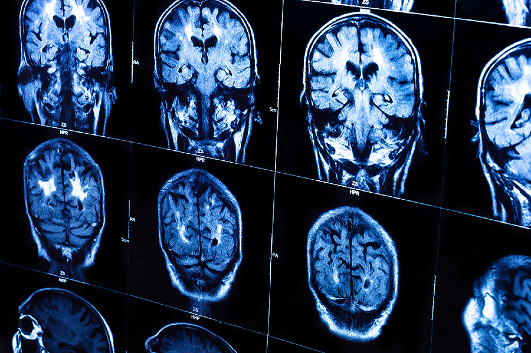 Brain scans. 
