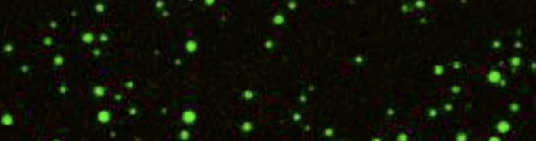 Zoom image: Like stars in the night, liquid droplets of RNA (the bright green spheres) float in a solution containing high concentrations of divalent magnesium cations. The droplets are imaged through confocal fluorescence microscopy. Credit: P. Onuchic, A. Milin, I. Alshareedah, A. Deniz and P. Banerjee, Scientific Reports, Aug. 21, 2019. This work is licensed under CC BY-4.0 (https://creativecommons.org/licenses/by/4.0/). 