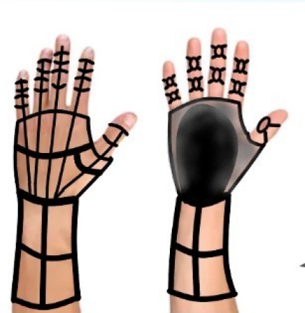 Saebo glove. 