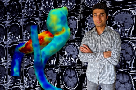 Zoom image: Sricharan&nbsp;Veeturi.&nbsp;Non-invasive Imaging biomarkers for risk stratification of brain aneurysms. 