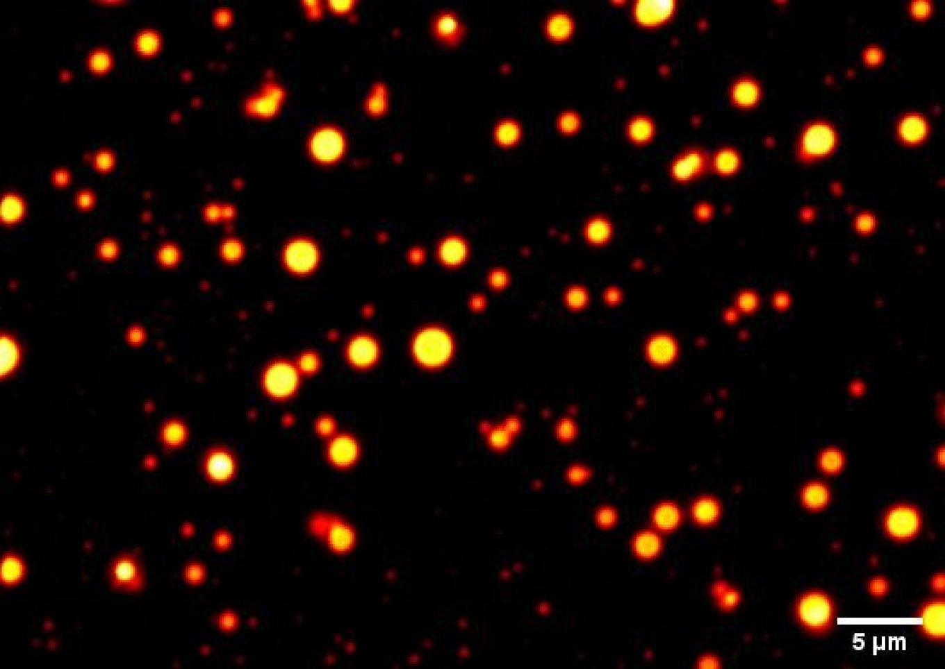 Zoom image: Researchers have found that RNA molecules can undergo phase separation in a temperature-dependent manner, and this phase behavior is supported by magnesium ions in solution. Here, CAG-repeat RNA droplets are shown in a physiologically relevant buffer. Photo: Gable Wadsworth and Priya Banerjee 