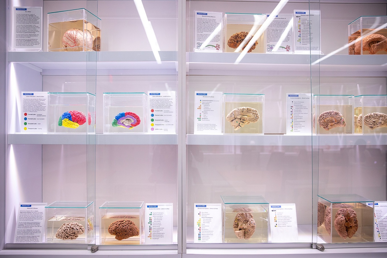 Brain museum located in the Jacobs school. 