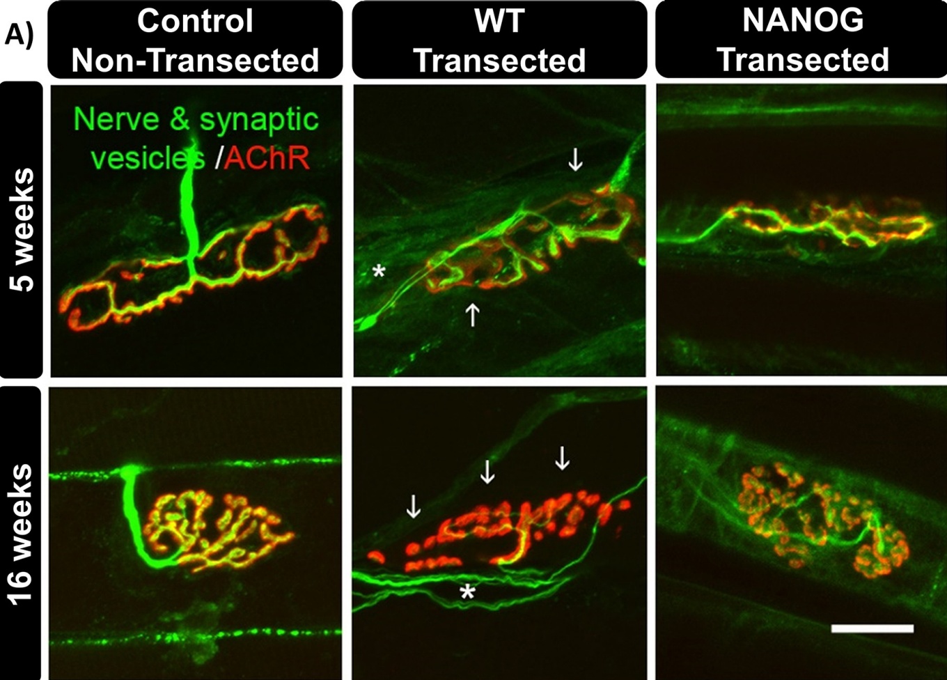 images showing neuromuscular junctions in a control group, a group with a sciatic injury and a group with a sciatic injury where NANOG was expressed.